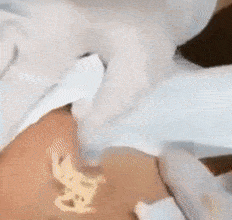 2018挤黑头视频,揭秘面部清洁新潮流